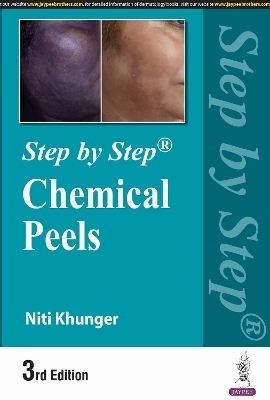 Step by Step: Chemical Peels - Niti Khunger