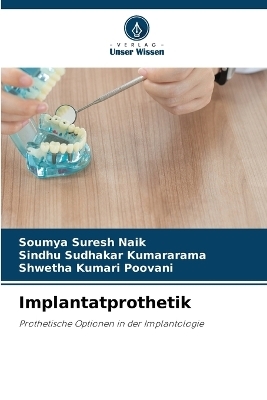 Implantatprothetik - Soumya Suresh Naik, Sindhu Sudhakar Kumararama, Shwetha Kumari Poovani