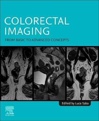 Colorectal Imaging - 