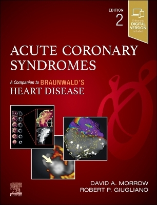 Acute Coronary Syndromes