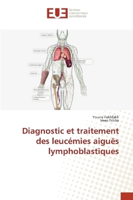 Diagnostic et traitement des leuc&eacute;mies aigu&euml;s lymphoblastiques - Yousra Fakhfakh, Imen Frikha