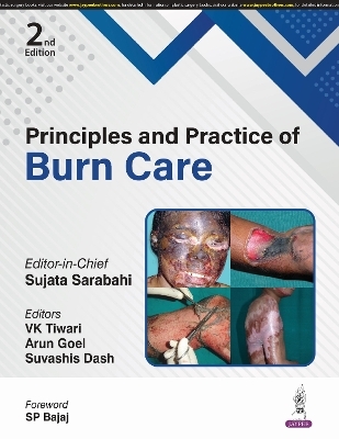 Principles and Practice of Burn Care - Sujata Sarabahi, VK Tiwari, Arun Goel, Suvashis Dash