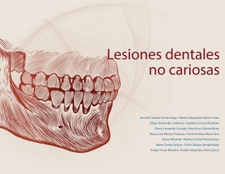 Lesiones dentales no cariosas