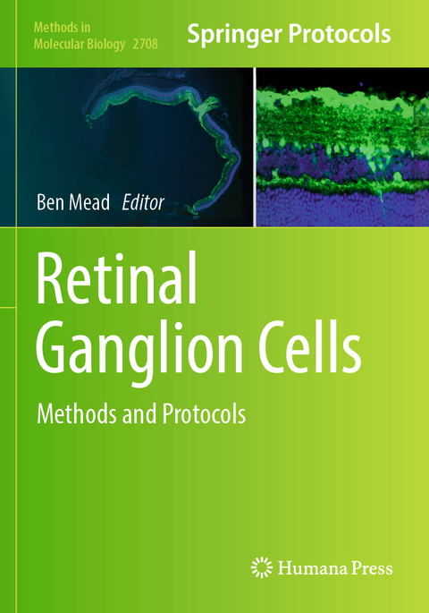 Retinal Ganglion Cells - 