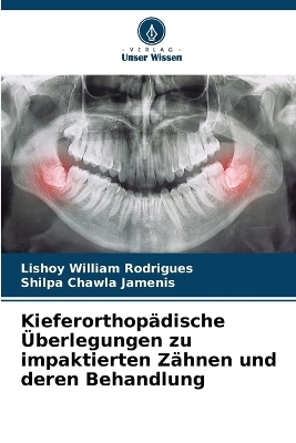 Kieferorthop&auml;dische &Uuml;berlegungen zu impaktierten Z&auml;hnen und deren Behandlung - Lishoy William Rodrigues, Shilpa Chawla Jamenis