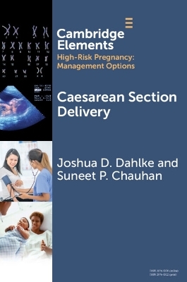 Caesarean Section Delivery - Joshua D. Dahlke, Suneet P. Chauhan