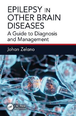 Epilepsy in Other Brain Diseases - Johan Zelano