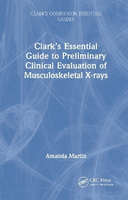 Clark’s Essential Guide to Preliminary Clinical Evaluation of Musculoskeletal X-rays