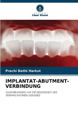 Implantat-Abutment-Verbindung