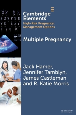Multiple Pregnancy - Jack Hamer, Jennifer Tamblyn, James Castleman, R. Katie Morris