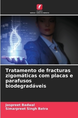 Tratamento de fracturas zigom&aacute;ticas com placas e parafusos biodegrad&aacute;veis - Jaspreet Badwal, Simarpreet Singh Batra