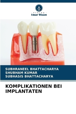 Komplikationen Bei Implantaten - SUBHRANEEL BHATTACHARYA, Shubham Kumar, Subhasis Bhattacharya