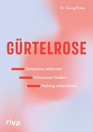 Gürtelrose