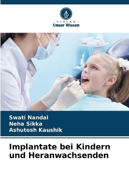 Implantate bei Kindern und Heranwachsenden - Swati Nandal, Neha Sikka, Ashutosh Kaushik