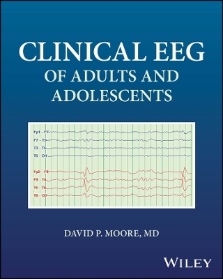 Clinical EEG of Adults and Adolescents
