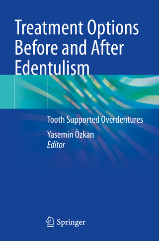 Treatment Options Before and After Edentulism