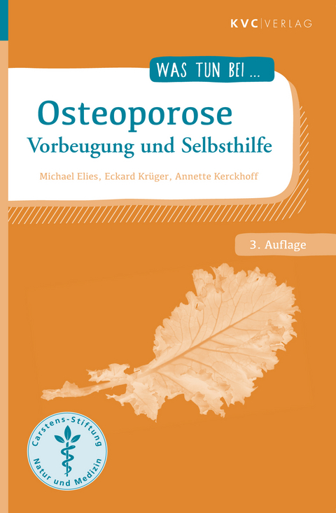 Osteoporose - Michael Elies, Eckard Kr&uuml;ger, Annette Kerckhoff