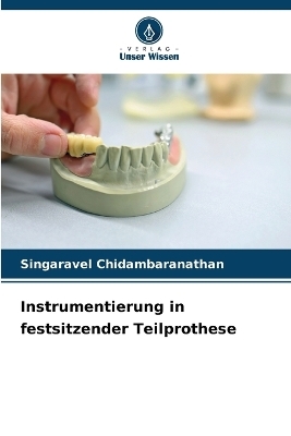 Instrumentierung in festsitzender Teilprothese - Singaravel Chidambaranathan