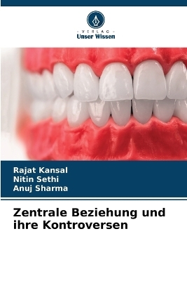 Zentrale Beziehung und ihre Kontroversen - Rajat Kansal, Nitin Sethi, Anuj Sharma