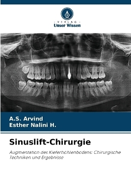 Sinuslift-Chirurgie - A S Arvind, Esther Nalini H