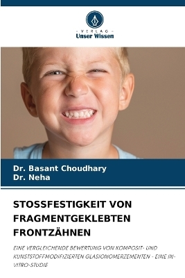 Stossfestigkeit Von Fragmentgeklebten Frontz&auml;hnen - Dr Basant Choudhary, Dr Neha