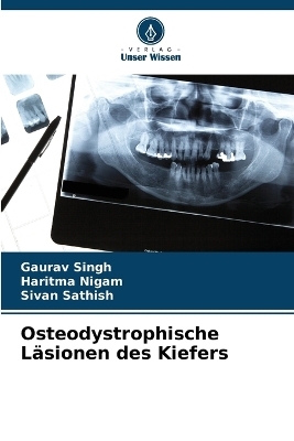 Osteodystrophische L&auml;sionen des Kiefers - Gaurav Singh, Haritma Nigam, SIVAN SATHISH