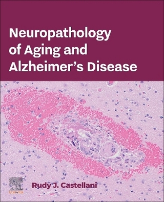 Neuropathology of Aging and Alzheimer’s Disease