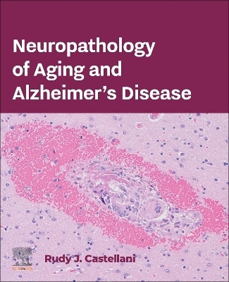 Neuropathology of Aging and Alzheimer’s Disease - Rudy J. Castellani