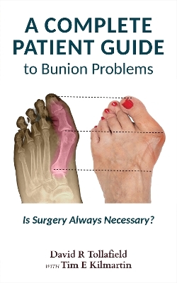 The Complete Patient Guide to Bunion Problems.