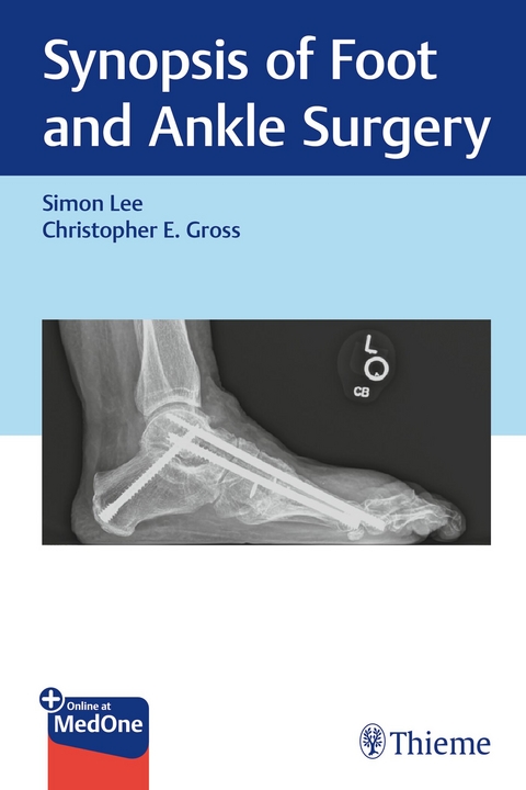 Synopsis of Foot and Ankle Surgery - Simon Lee, Christopher Gross