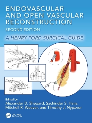 Endovascular and Open Vascular Reconstruction - 
