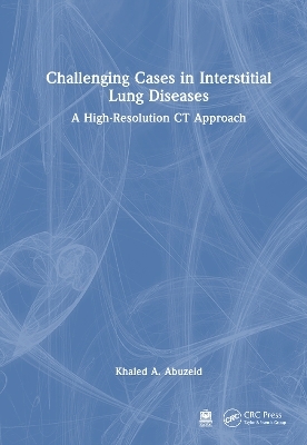Challenging Cases in Interstitial Lung Diseases - Khaled A. Abuzeid