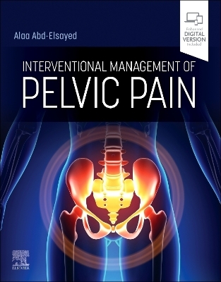 Interventional Management of Pelvic Pain - 