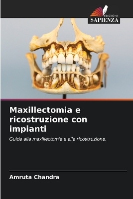 Maxillectomia e ricostruzione con impianti - Amruta Chandra