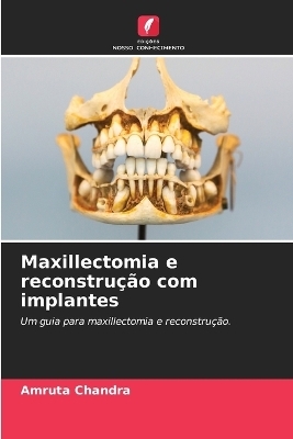 Maxillectomia e reconstru&ccedil;&atilde;o com implantes - Amruta Chandra