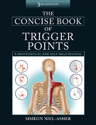 The Concise Book of Trigger Points - Simeon Niel-Asher