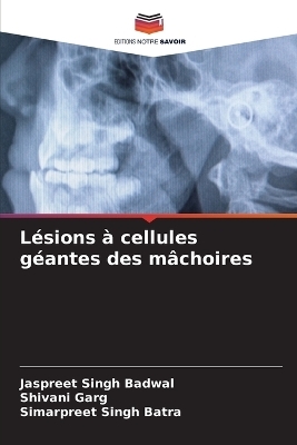 L&eacute;sions &agrave; cellules g&eacute;antes des m&acirc;choires - Jaspreet Singh Badwal, Shivani Garg, Simarpreet Singh Batra