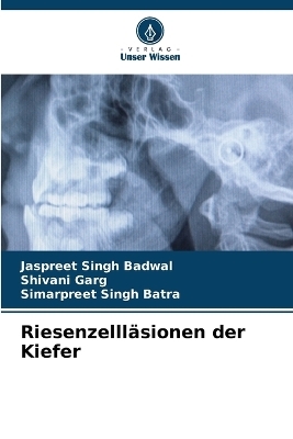 Riesenzelll&auml;sionen der Kiefer - Jaspreet Singh Badwal, Shivani Garg, Simarpreet Singh Batra