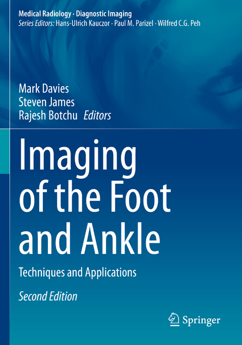 Imaging of the Foot and Ankle - 