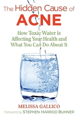 The Hidden Cause of Acne - Melissa Gallico