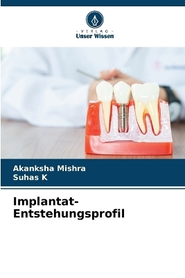Implantat-Entstehungsprofil - Akanksha Mishra, Suhas K