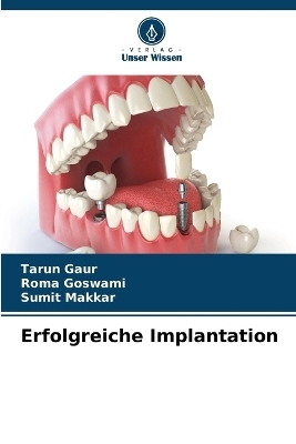 Erfolgreiche Implantation - Tarun Gaur, Roma Goswami, Sumit Makkar