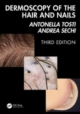 Dermoscopy of the Hair and Nails 3e - Tosti, Antonella; Sechi, Andrea