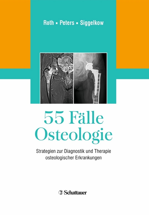 55 F&auml;lle Osteologie - 