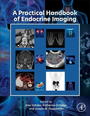 A Practical Handbook of Endocrine Imaging - 