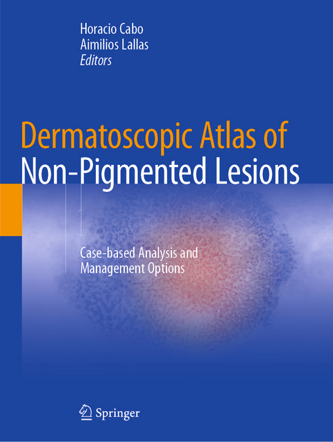 Dermatoscopic Atlas of Non-Pigmented Lesions - 