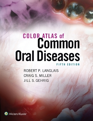 Color Atlas of Common Oral Diseases - Robert Langlais, Craig Miller