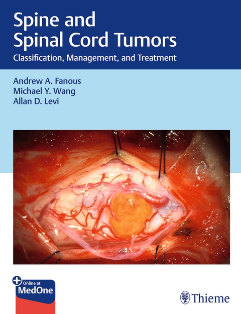 Spine and Spinal Cord Tumors - Andrew Fanous, Michael Wang, Allan Levi