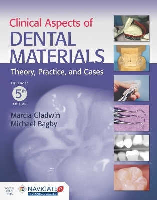 Clinical Aspects of Dental Materials - Marcia (gladwin) Stewart, Michael Bagby