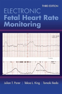 Electronic Fetal Heart Rate Monitoring: the 5-Tier System - Julian T. Parer, Tekoa L. King, Tomoaki Ikeda